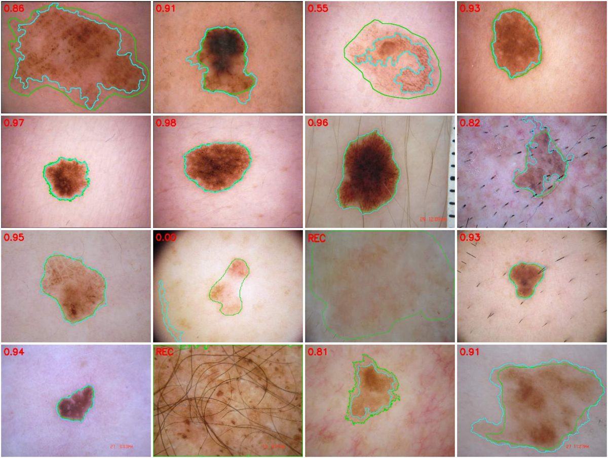 Dezesseis imagens do teste cego sorteadas sem olhar o resultado, com o contorno do especialista e o da ferramenta